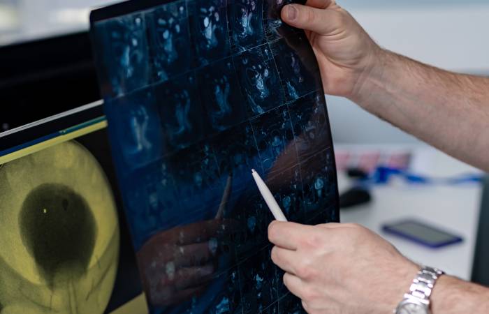 Tomografia Computarizada