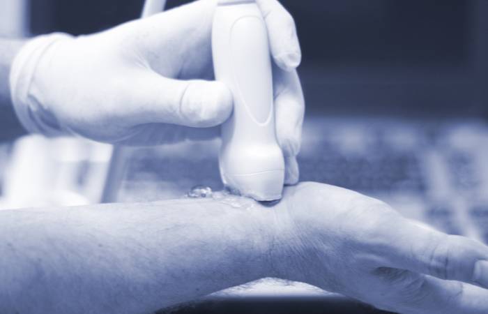 Tomografia Computarizada