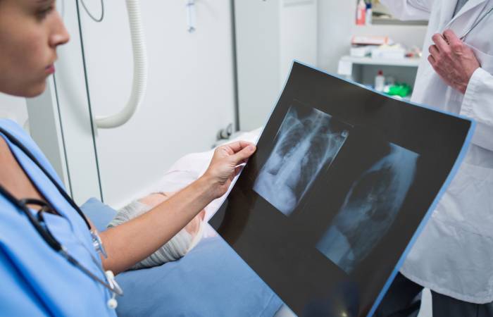 Tomografia Computarizada